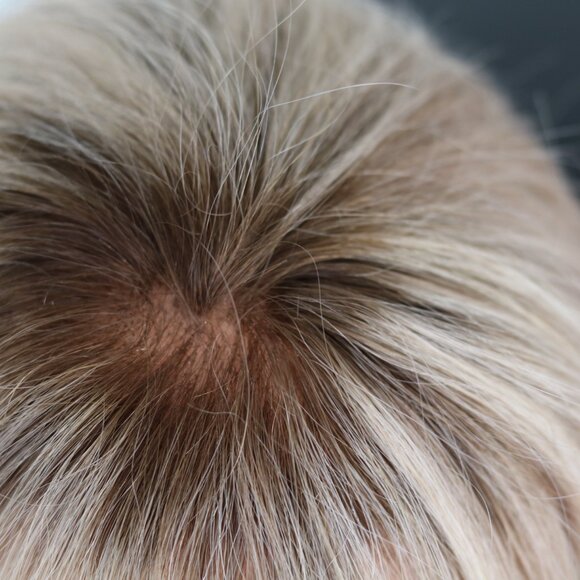 Human Hair Topper - Picture 2 of 7